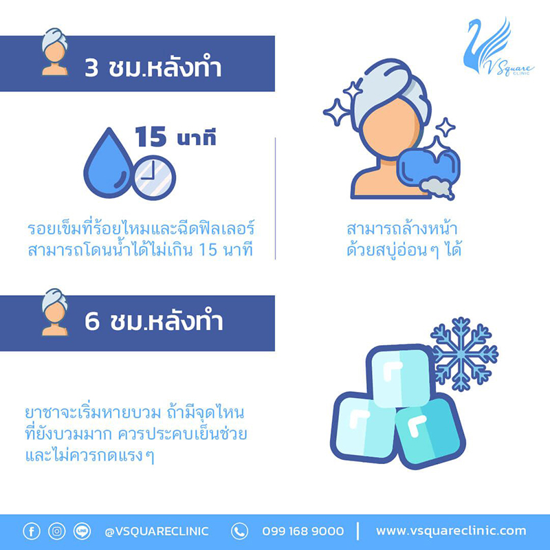 3-6-ชม.-หลังฉีดฟิลเลอร์สลายเร็ว