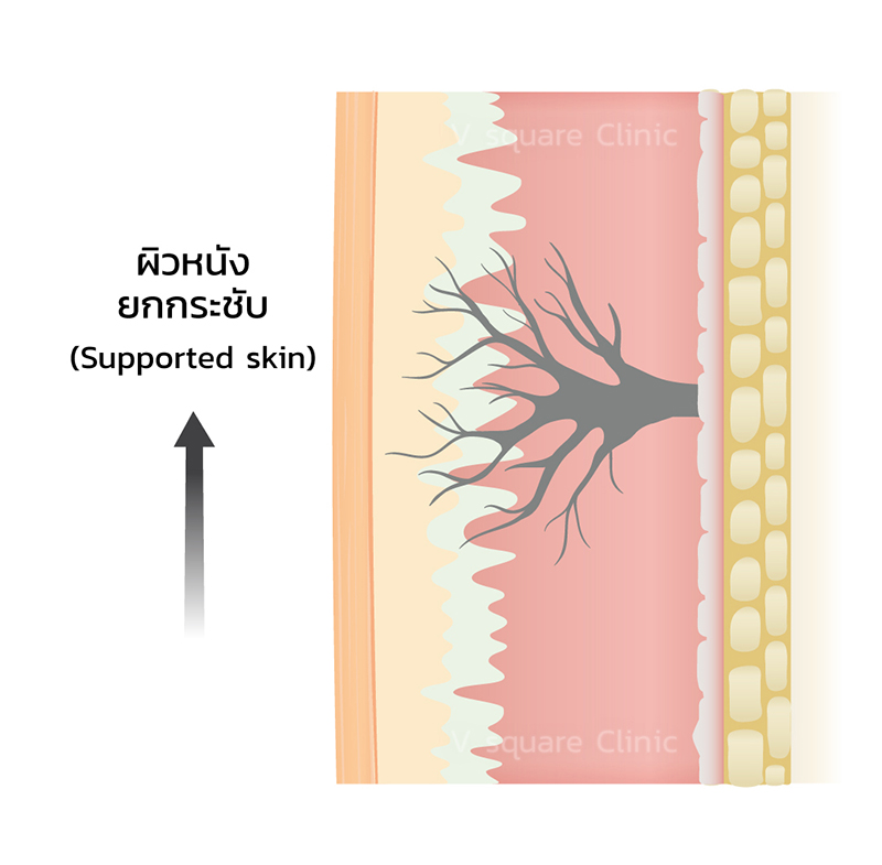 ligament-2