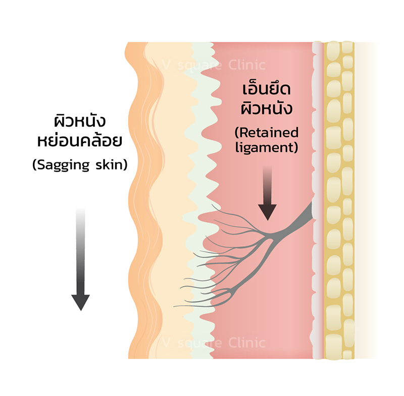 ligament-3