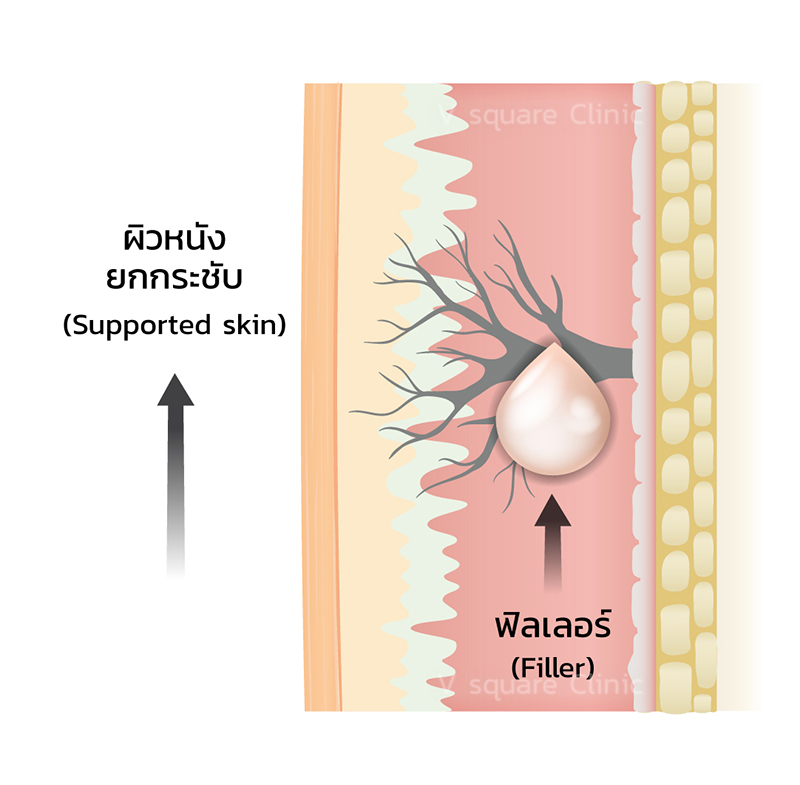 ligament-4