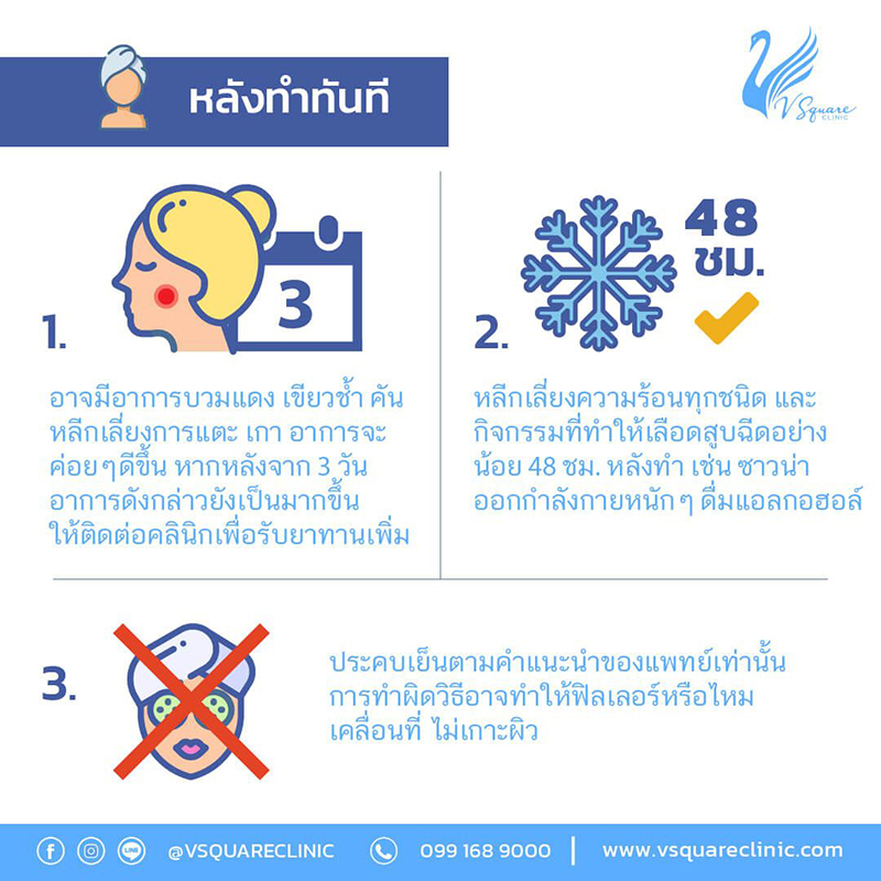 ฟิลเลอร์สลายเร็ว-หลังทำทันที-1