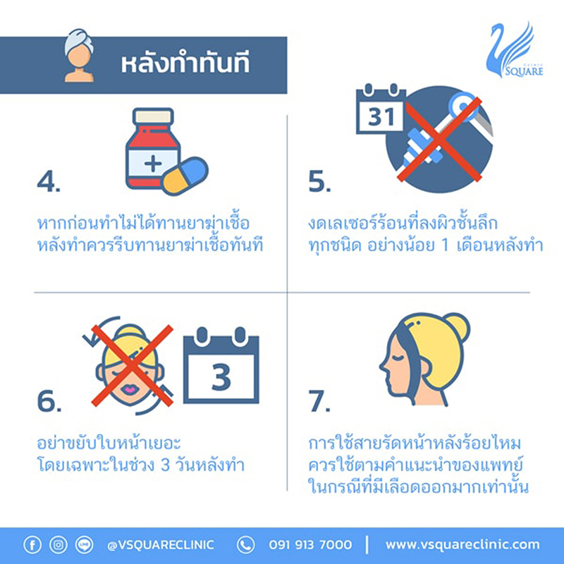 ฟิลเลอร์สลายเร็ว-หลังทำทันที-2