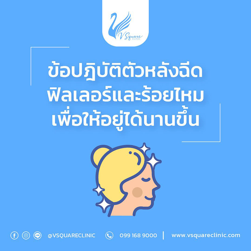 หลังฉีดฟิลเลอร์สลายเร็ว