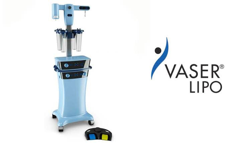 vaser ultrasound assisted liposuction