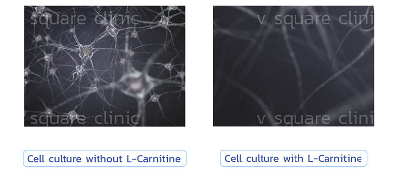 เมโสแฟต L-carnitine