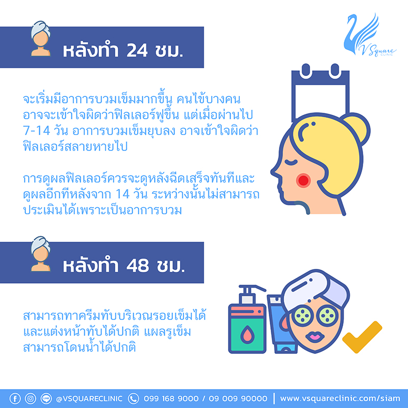 ข้อควรปฏิบัติหลังฉีดฟิลเลอร์