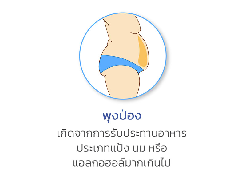 พุงป่อง