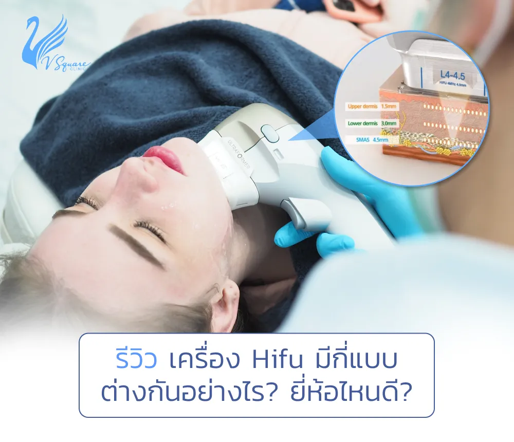 รีวิวเครื่องHifu