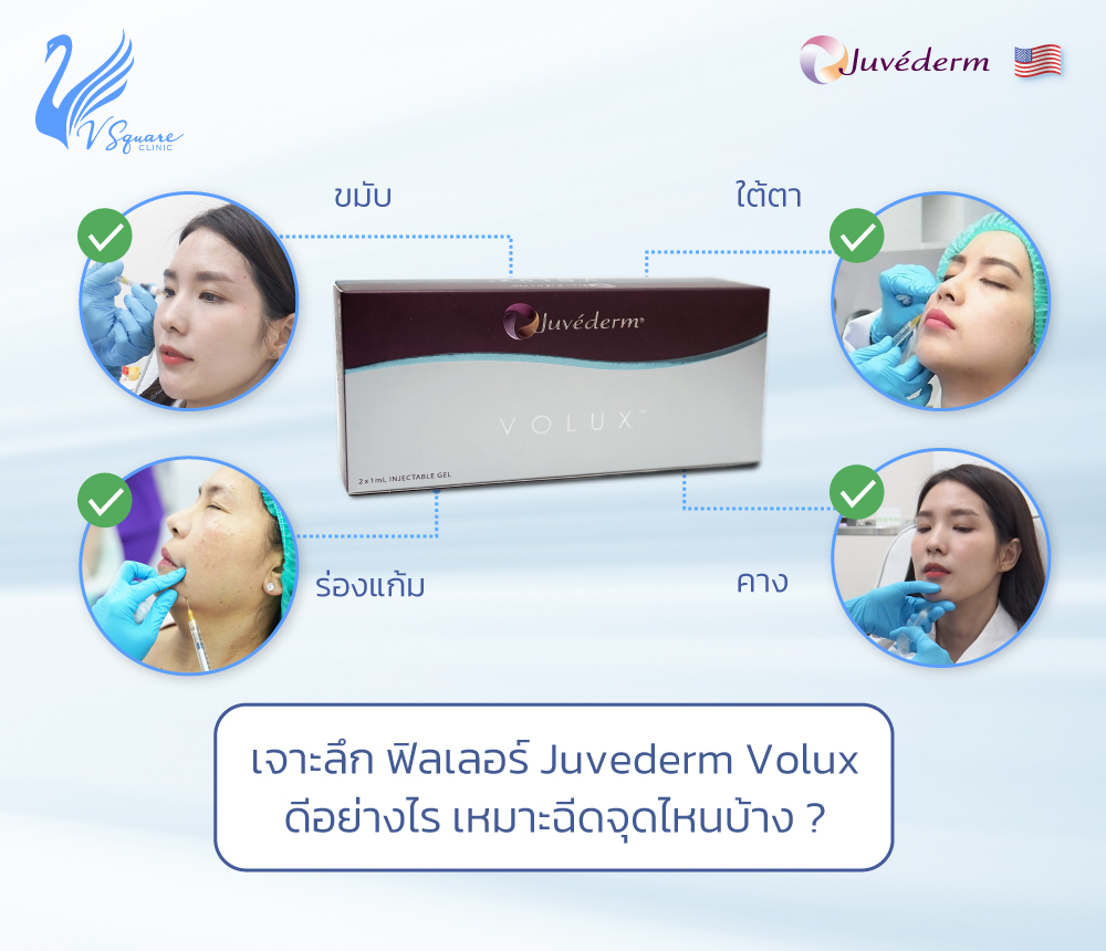 Juvederm Volux