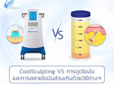 Coolsculpting