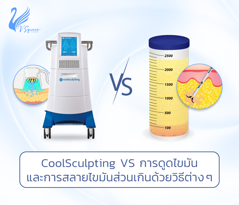 Coolsculpting