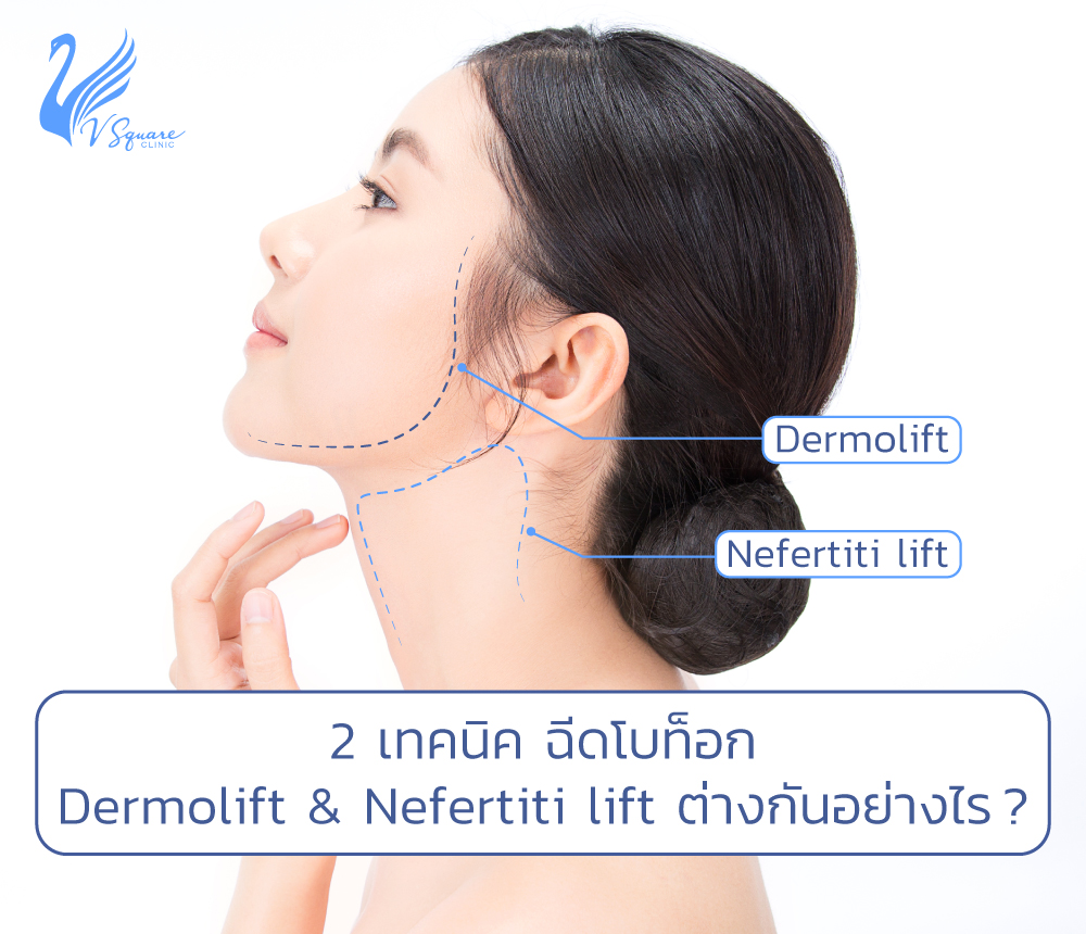 Dermolift & Nefertiti lift