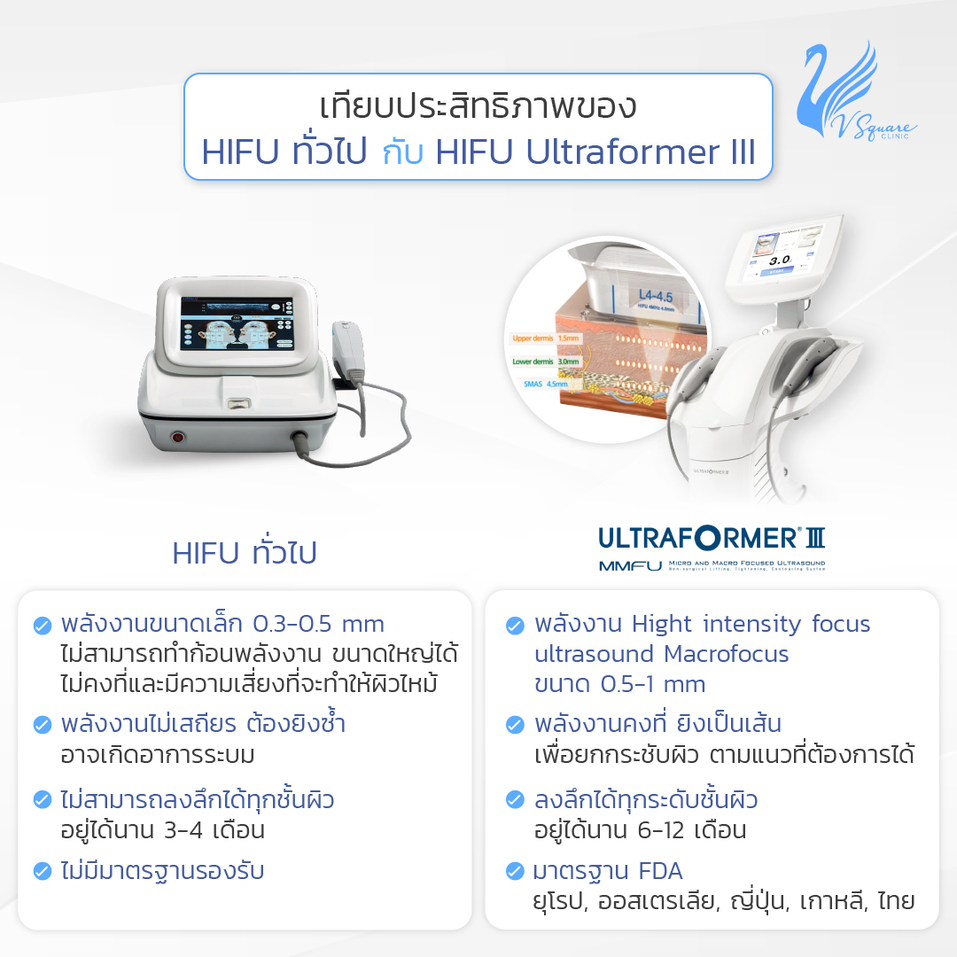 เครื่อง hifu ยี่ห้อ Ultraformer III ดีอย่างไร