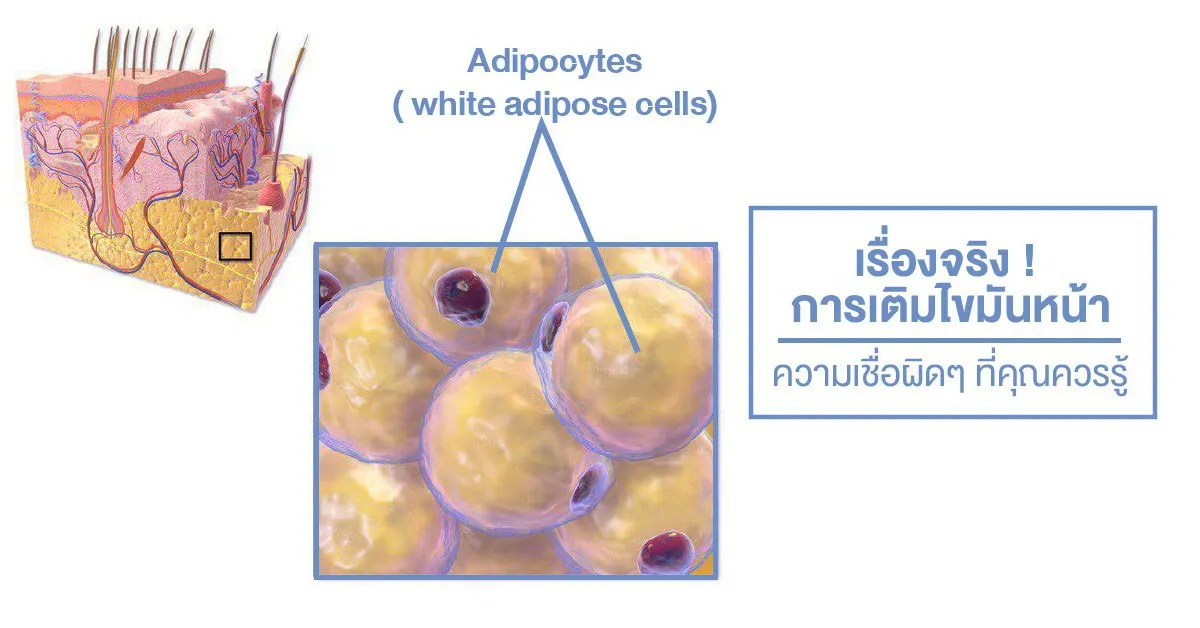 เติมไขมันหน้า