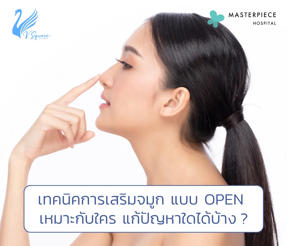 เสริมจมูกแบบโอเพ่นคืออะไร ดีอย่างไร เหมาะกับใครบ้าง แพงไหม หมอที่ไหนดี?