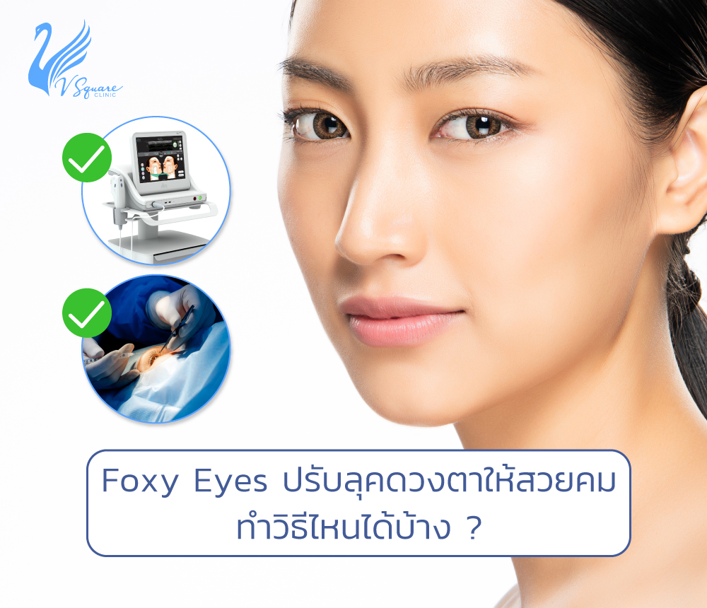 Foxy-Eyes-ปรับลุคดวงตาให้สวยคมทำวิธีไหน