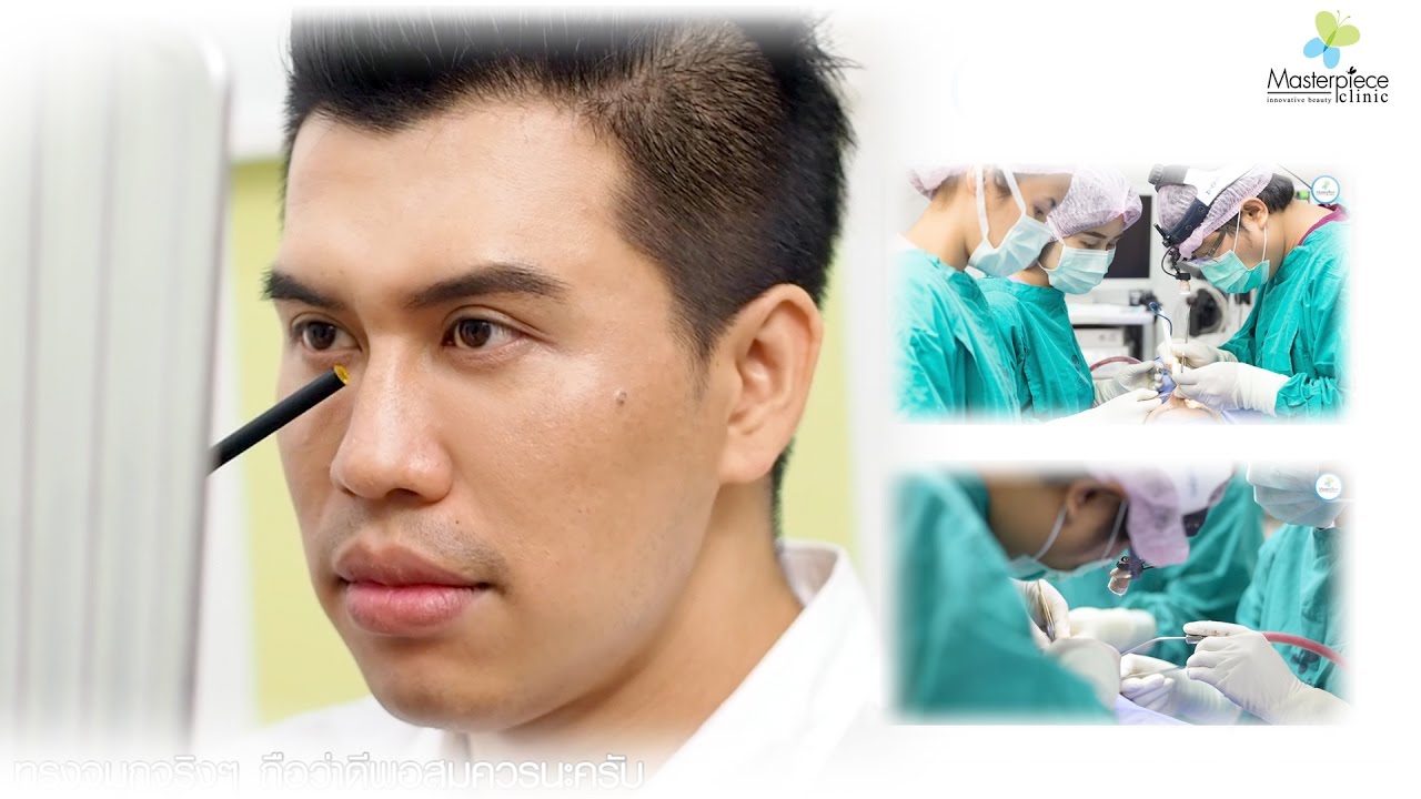 แก้ไขจมูกใหญ่ให้โด่งสวยเข้ากับหน้าด้วย Nose Reconstruction