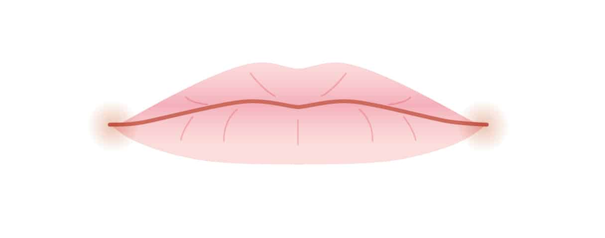 ปากคว่ำ