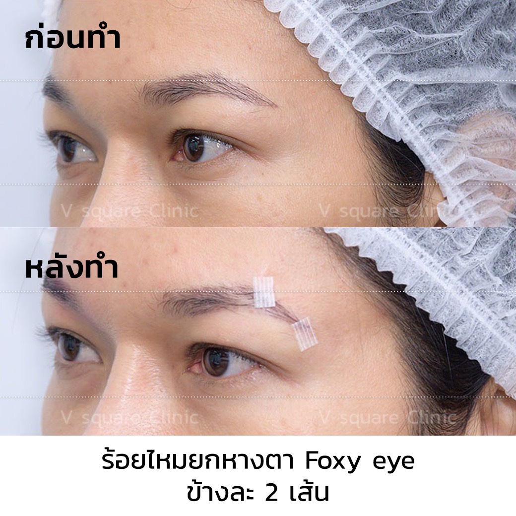 รีวิว Foxy Eyes