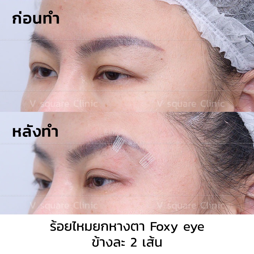 รีวิว Foxy Eyes