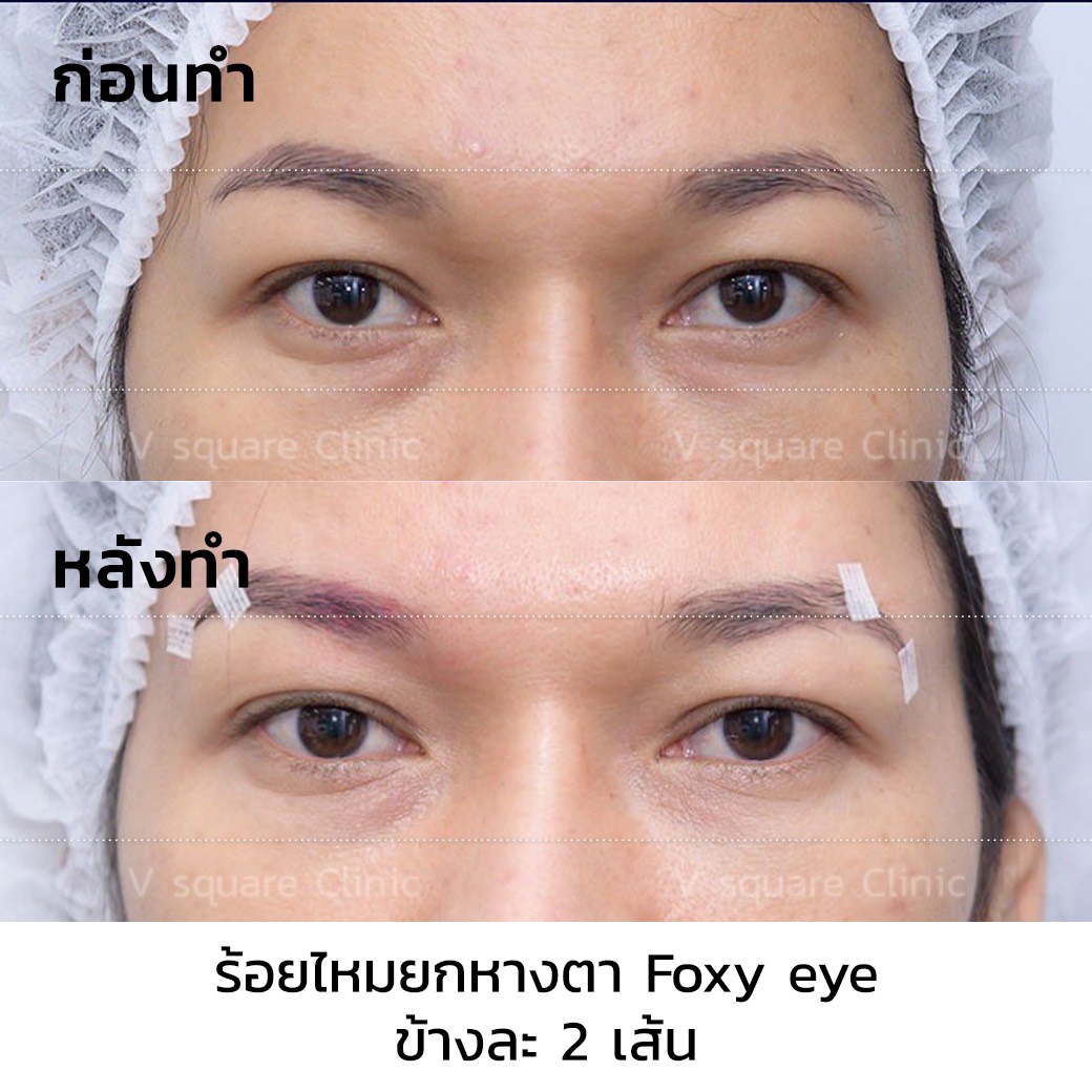 รีวิว Foxy Eyes