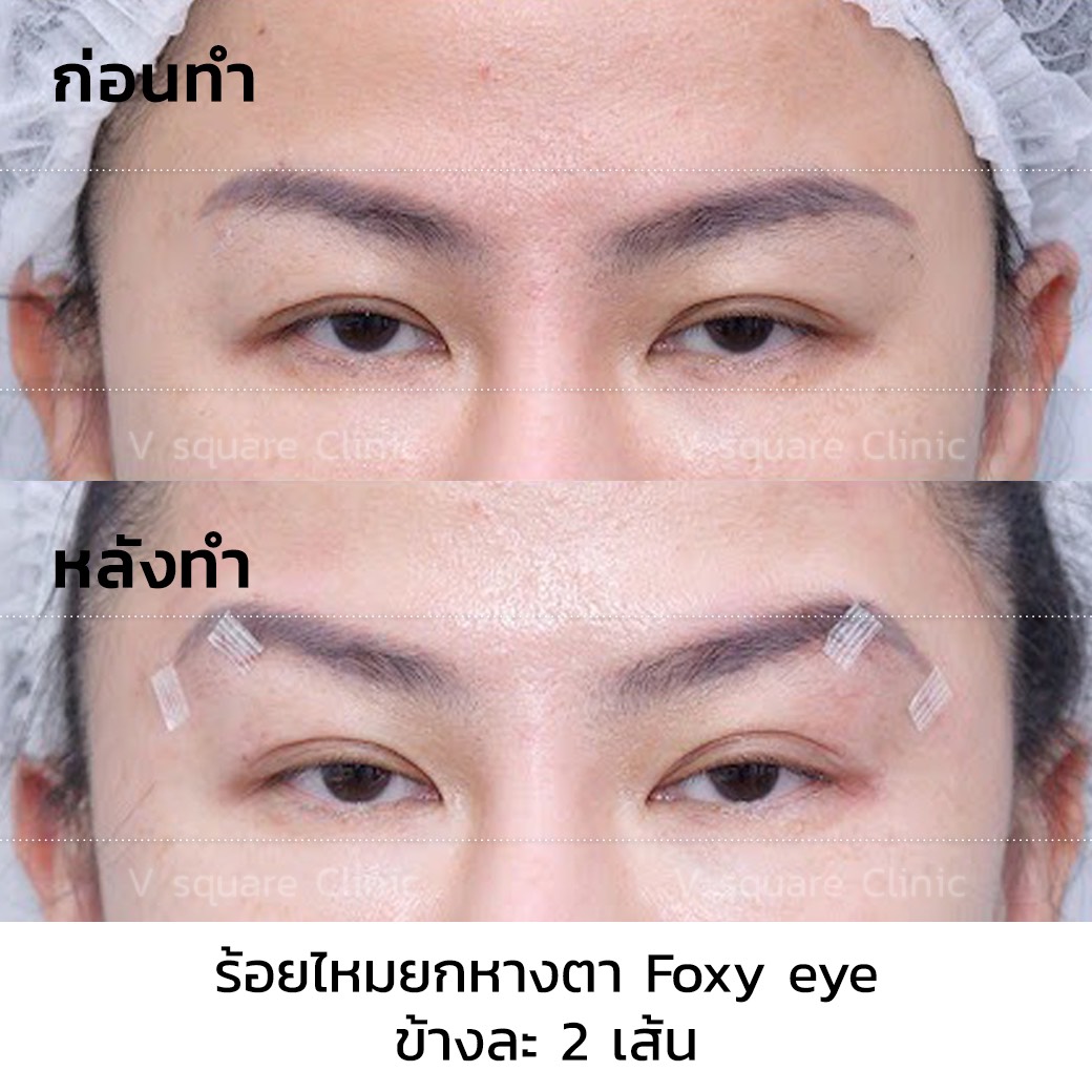 รีวิว Foxy Eyes