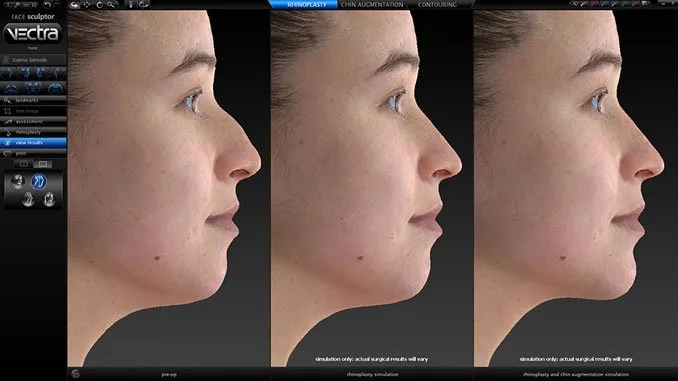 เครื่อง 3D Facial simulator