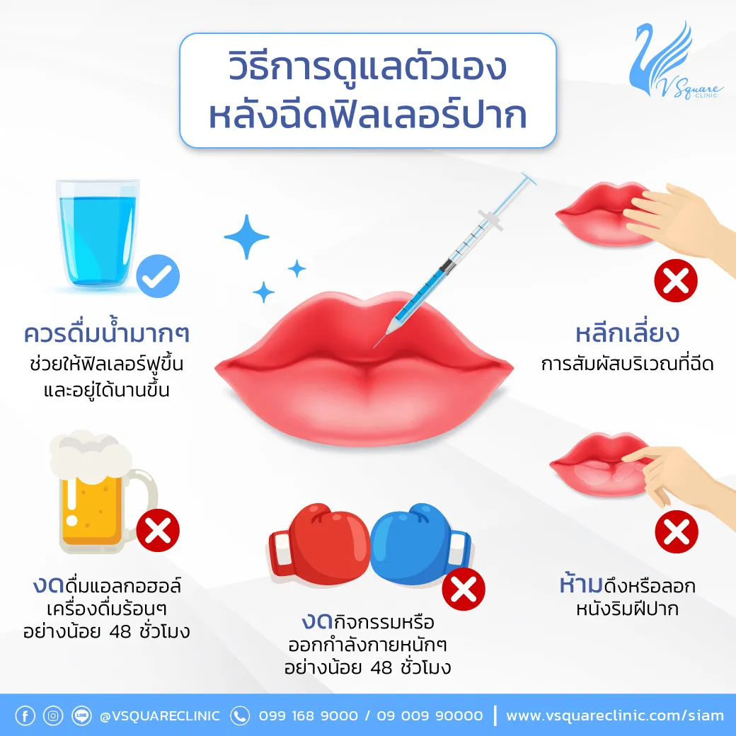 การดูแลตัวเองหลังฉีดฟิลเลอร์ Restylane Kysse