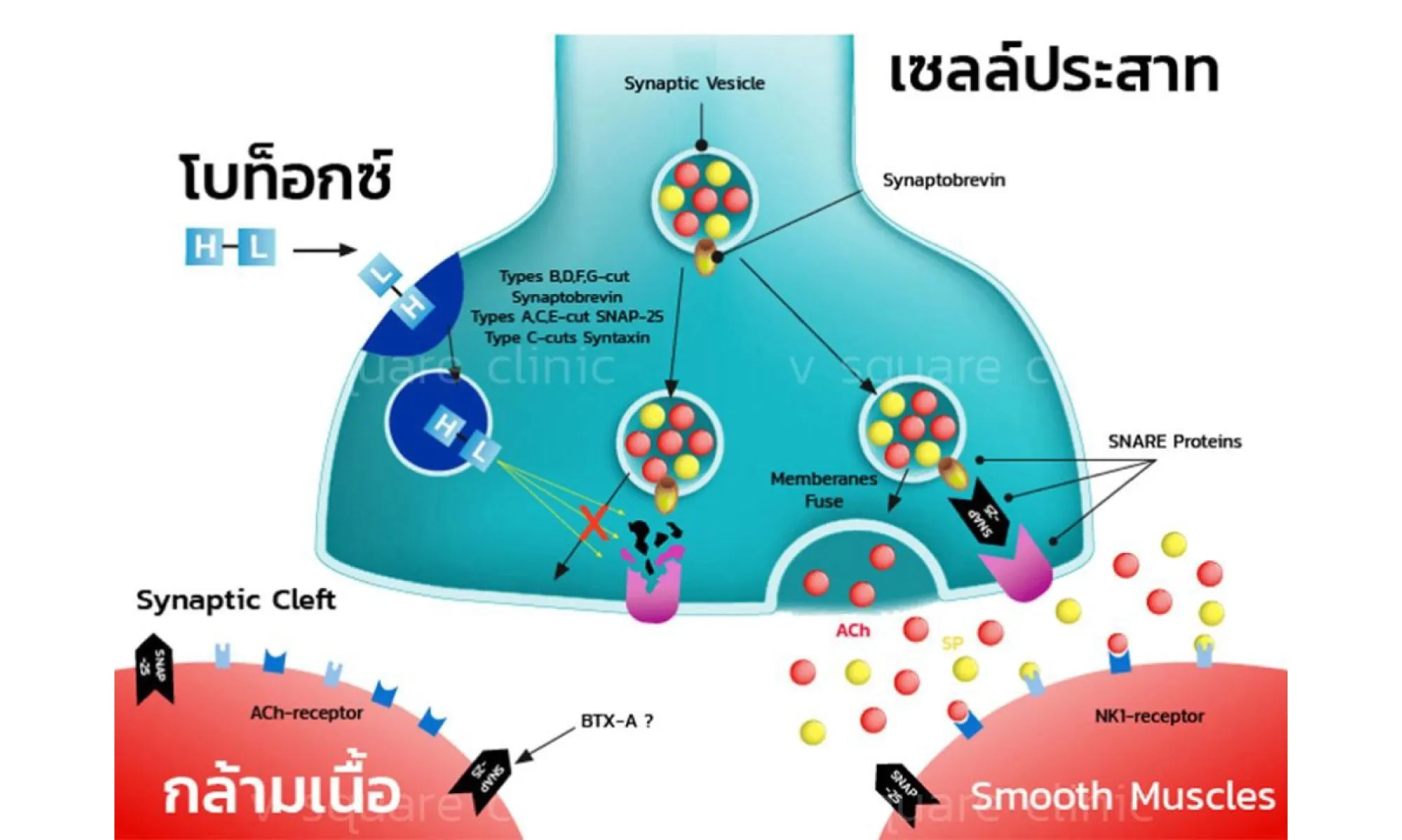 การกระจายตัวของโบทอก