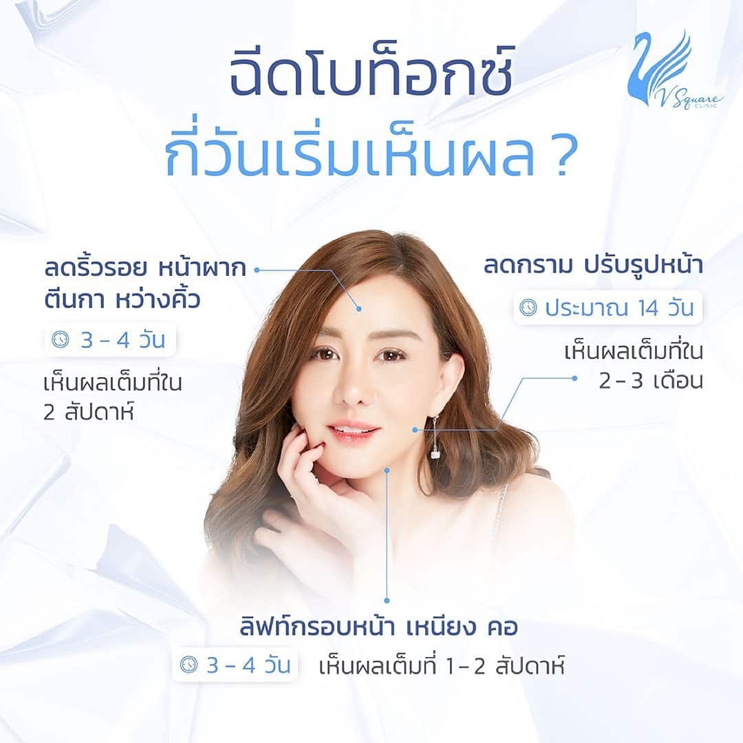 ฉีดโบท็อกลดริ้วรอยกี่วันเห็นผล ? คุณนิโคล