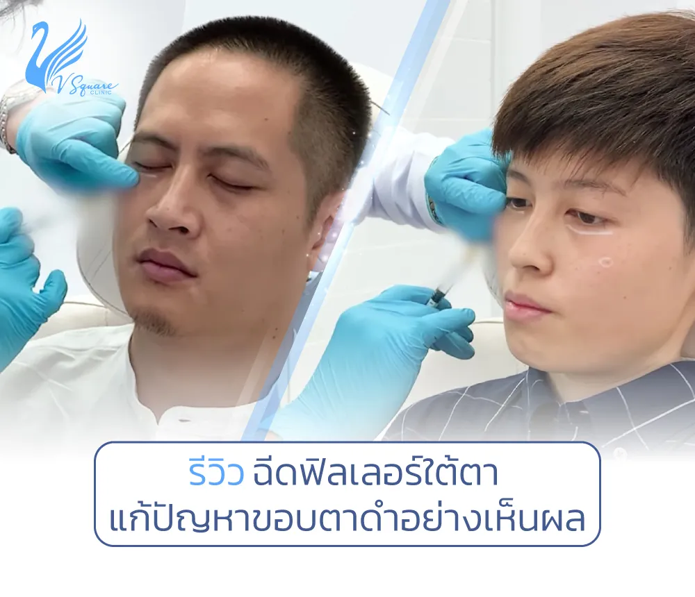 รีวิวฉีดฟิลเลอร์ใต้ตา-คุณไผ่-พลอยน้อย