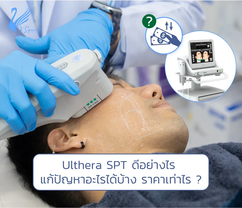 Ulthera SPT_1000x860