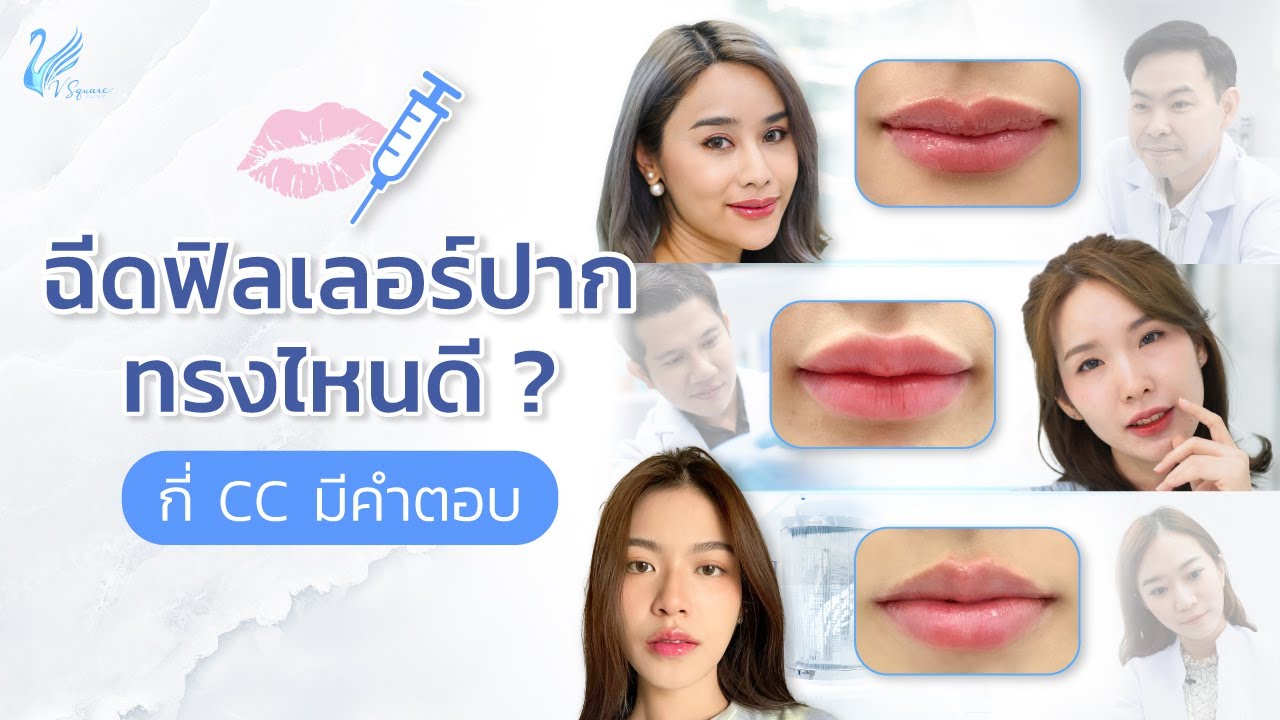 ฉีดฟิลเลอร์ปากทรงไหนดี-by-หมอโต้ง-มอซี-หมอเบิร์ด-หมอแพร-และหมอกอล์ฟ