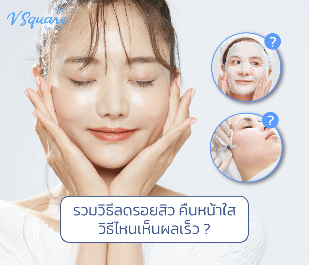 ลดรอยสิว