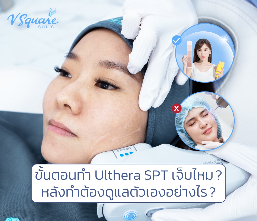 Ulthera เจ็บไหม