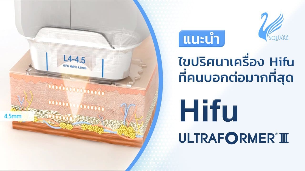 การทำงานของ hifu