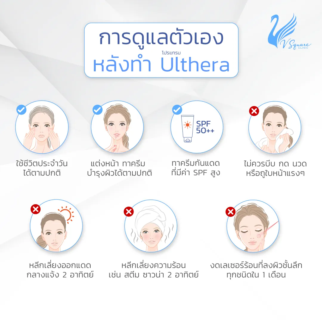 การดูแลหลังทำUlthera