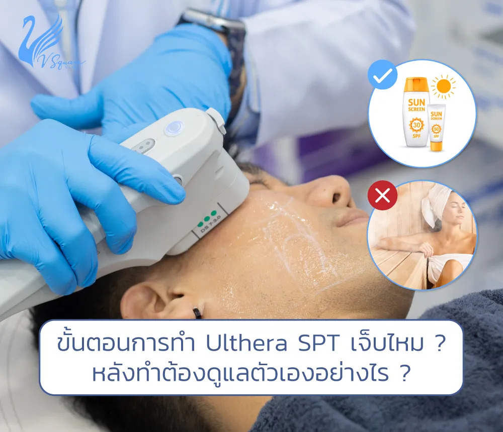 ขั้นตอนการทำ-Ulthera-เจ็บไหม 1000x860