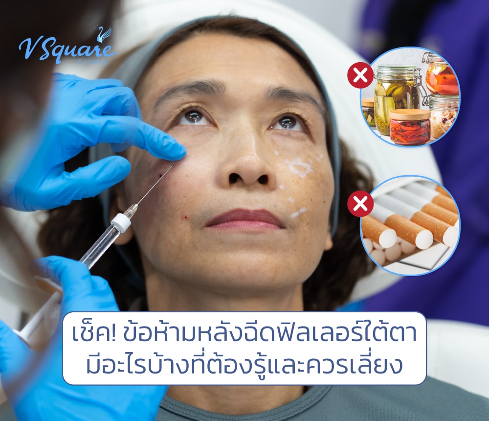 ข้อห้ามหลังฉีดฟิลเลอร์ใต้ตา
