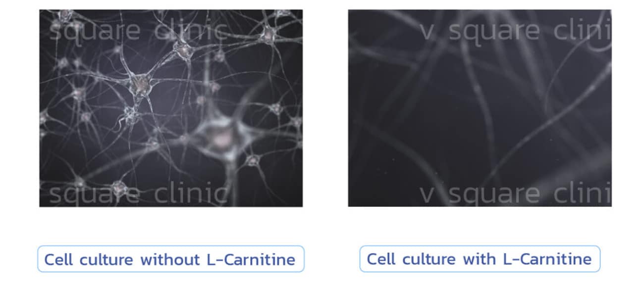 ในเมโสแฟตมี L-carnitine