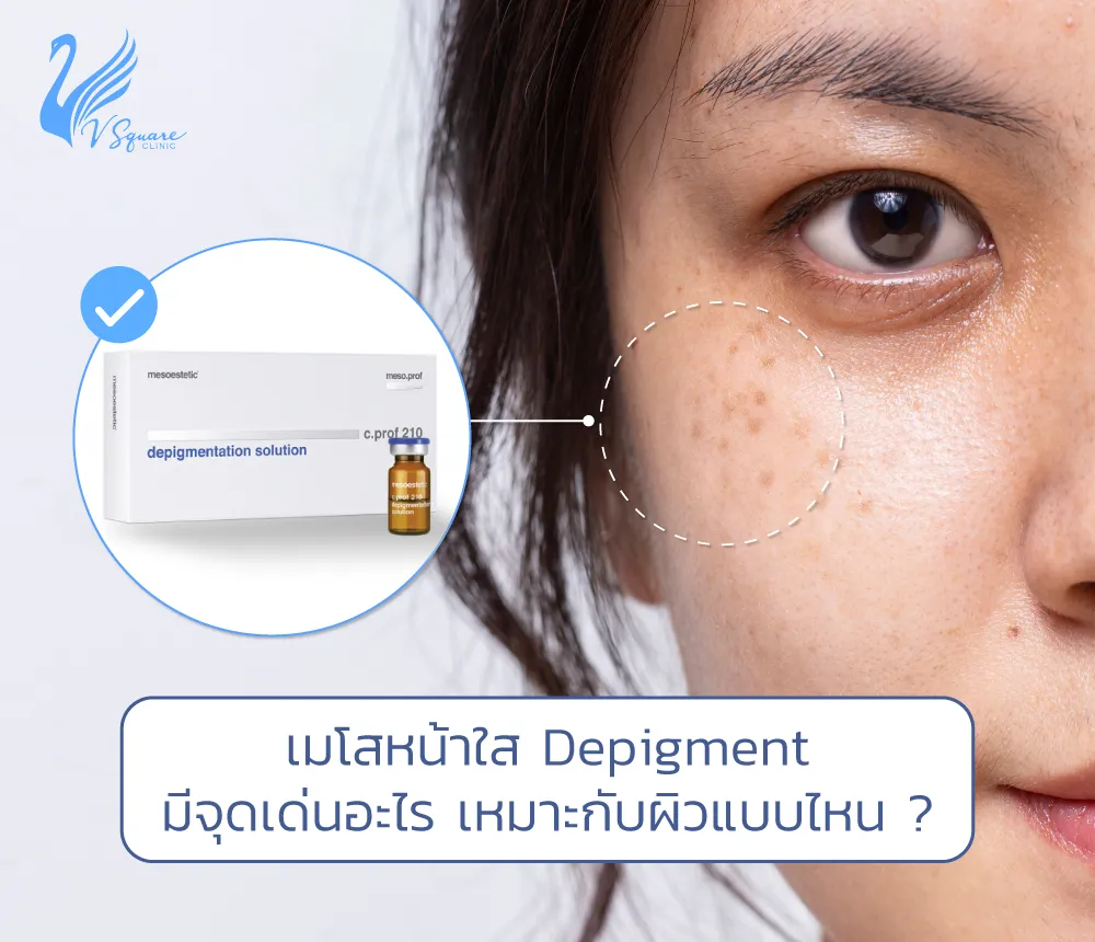เมโส Depigment สูตรลดฝ้า กระ จุดด่างดำ ดีอย่างไร ต่างกับยี่ห้ออื่นไหม ? เมโส Depigment สูตรลดฝ้า กระ จุดด่างดำ ดีอย่างไร ต่างกับยี่ห้ออื่นไหม ?