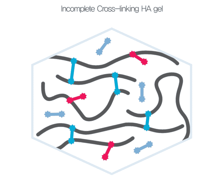 กระบวนการทำงานของ e.p.t.q. filler(1)