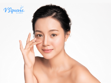 ตาไม่เท่ากัน 370x277