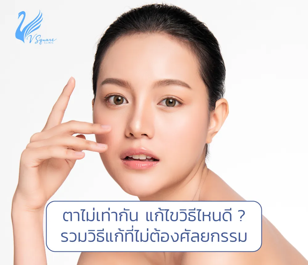 ตาไม่เท่ากัน-แก้ไขวิธีไหนดี