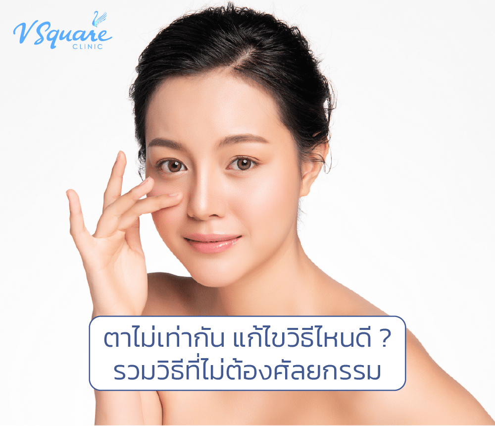 ตาไม่เท่ากัน