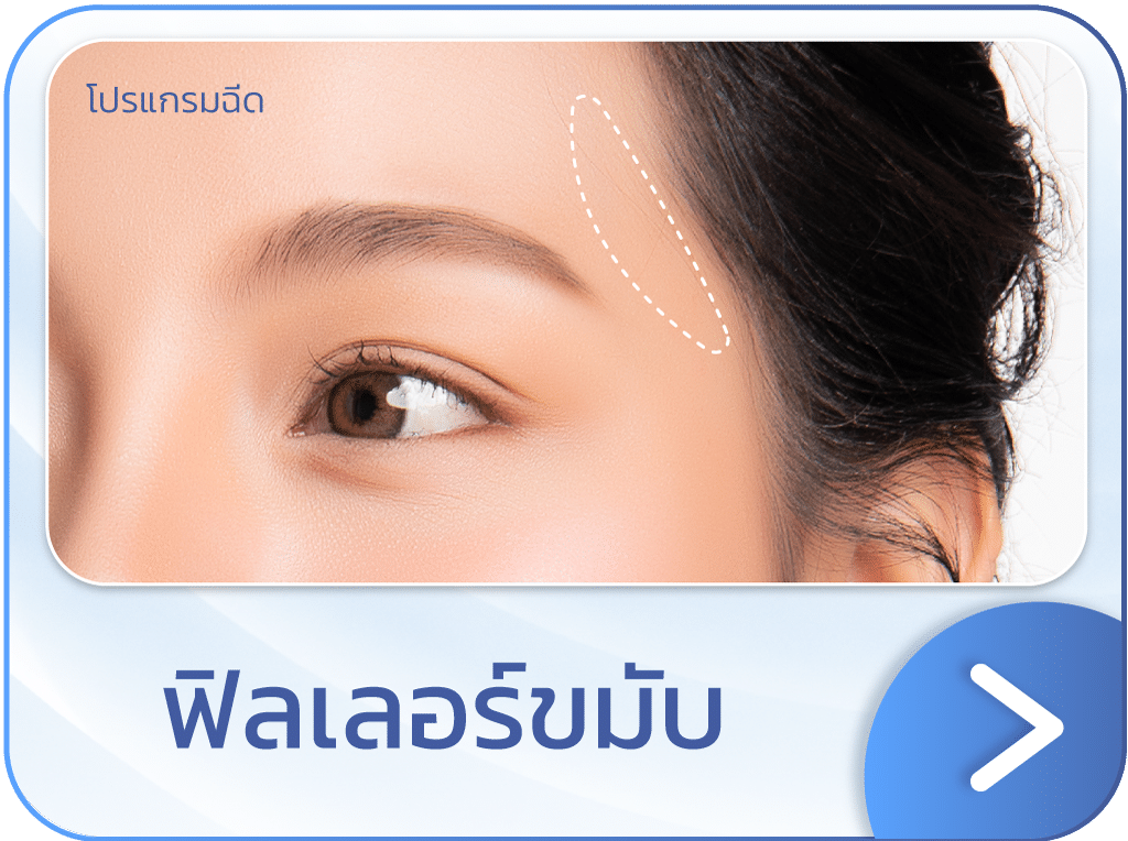 ฟิลเลอร์ขมับ