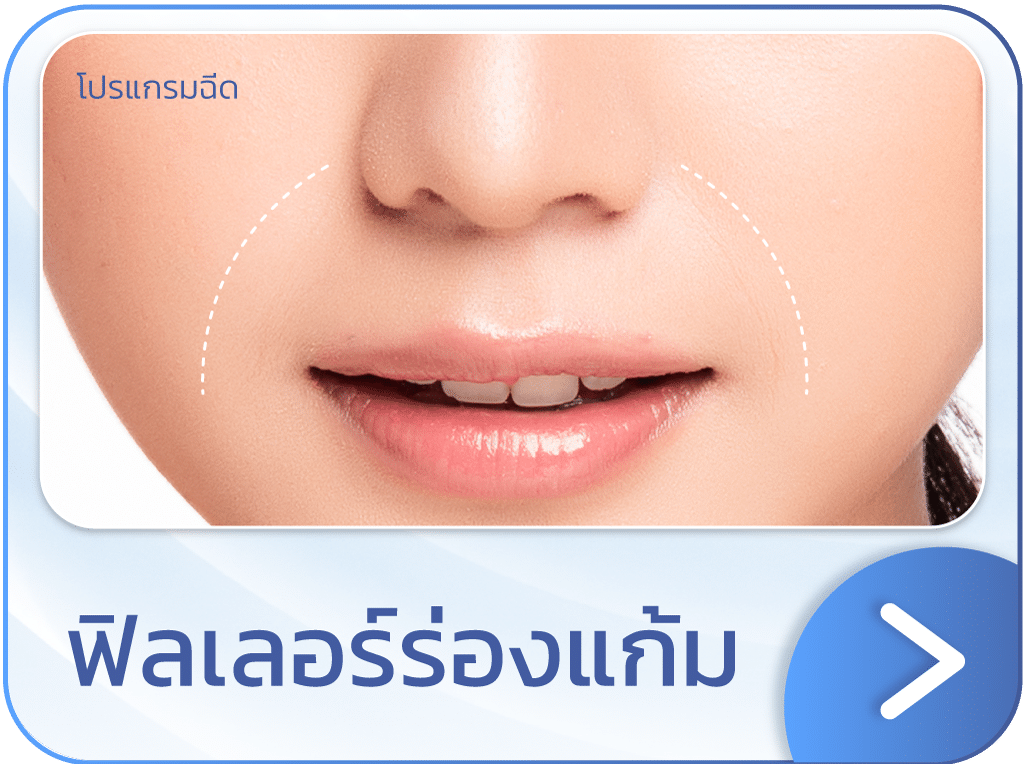 ฟิลเลอร์ร่องแก้ม