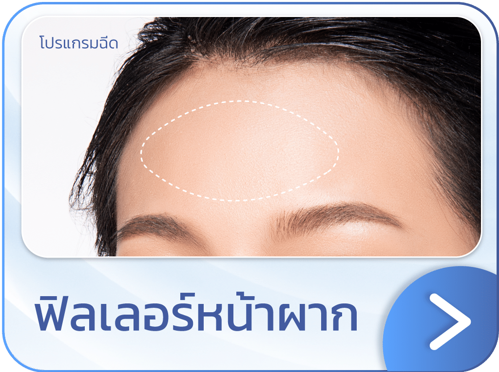 ฟิลเลอร์หน้าผาก