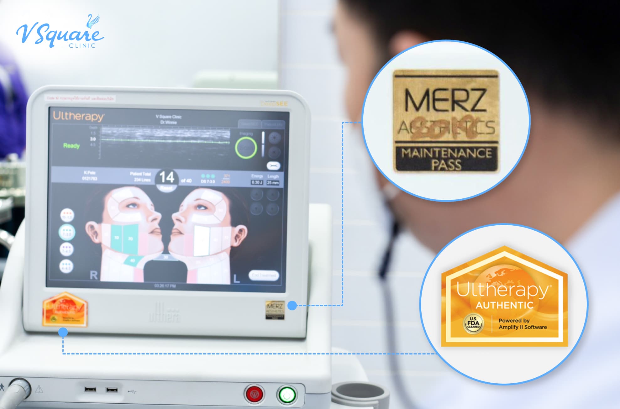 รีวิว ulthera แท้ V Square Clinic