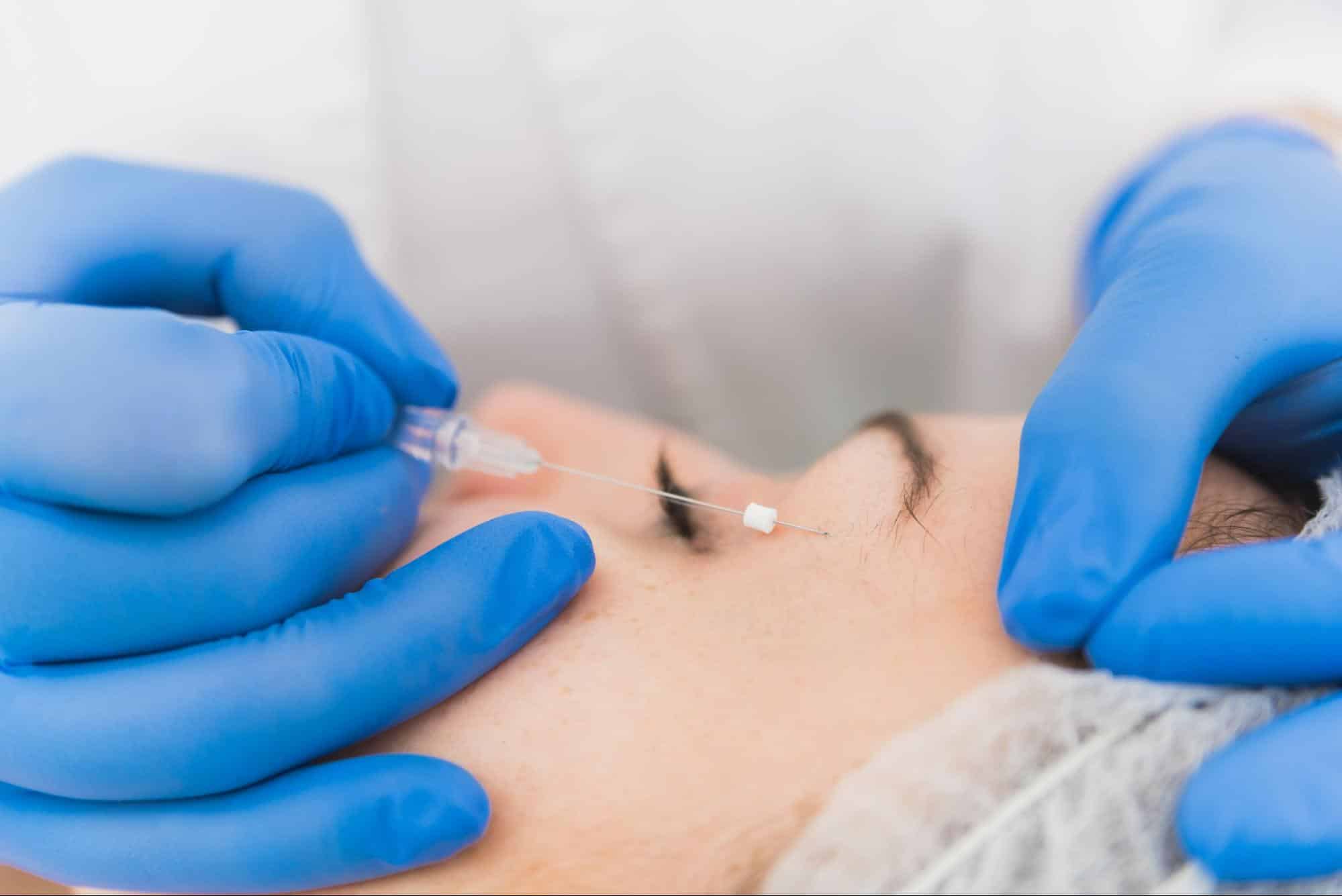 ร้อยไหม foxy eye